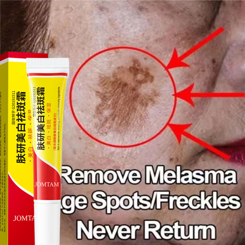 Skincare Niacinamide - Krem wybielający na piegi, krem rozjaśniający