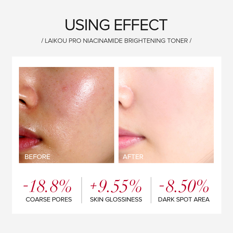 LAIKOU PRO Niacinamide 4-częśc – Skincare Niacinamide recenzja i cena