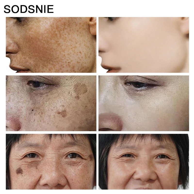 Środek do usuwania ciemnych pl – Skincare Niacinamide recenzja i cena