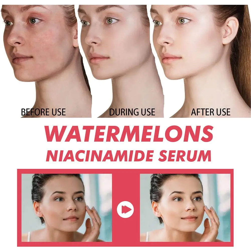 Arbuzowy blask niacynamid nawi – Skincare Niacinamide recenzja i cena