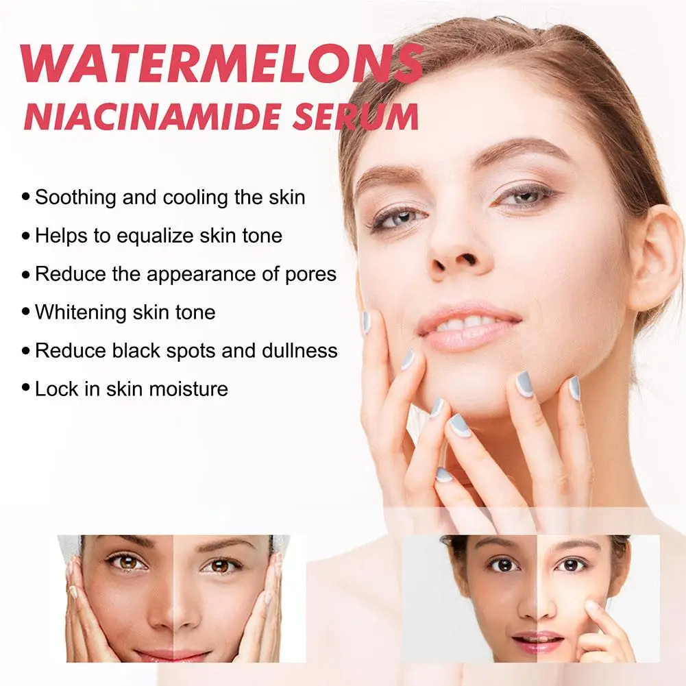 Arbuzowy blask niacynamid nawi – Skincare Niacinamide recenzja i cena