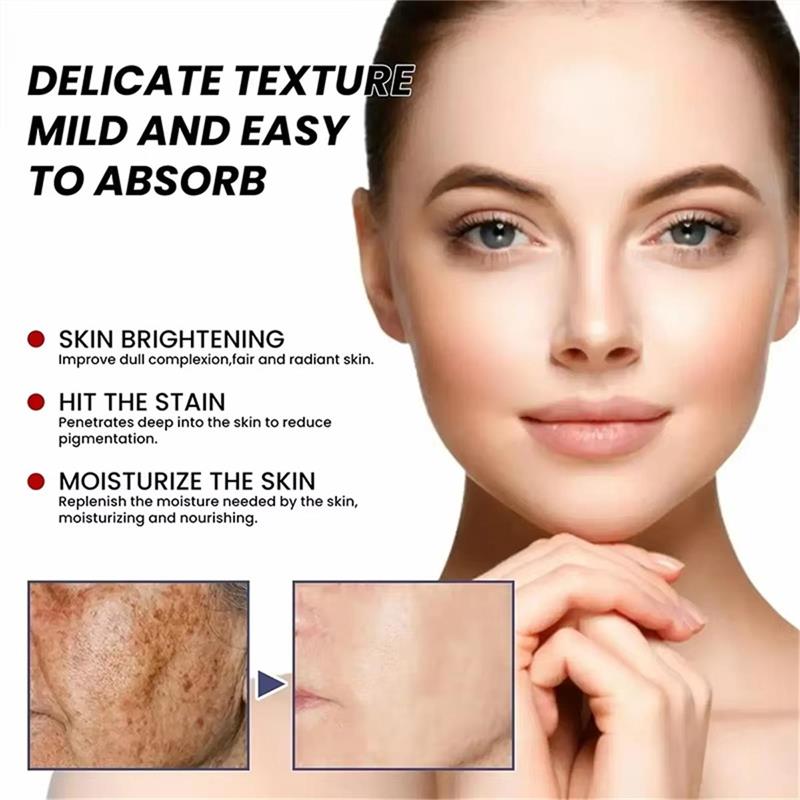 Krem wybielający na piegi, kre – Skincare Niacinamide recenzja i cena
